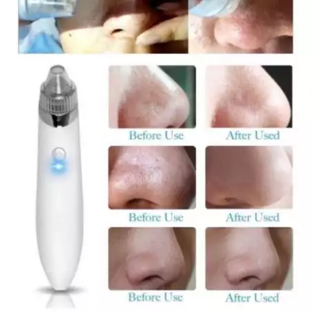 3. Снимка на Нов вакуумиращ уред за почистване на лице