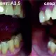 . Снимка на Кабинетна система за избелване на зъби BMS White - Italy